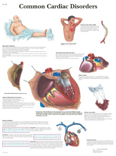 All Products - Wandkaart: Common Cardiac Disorders